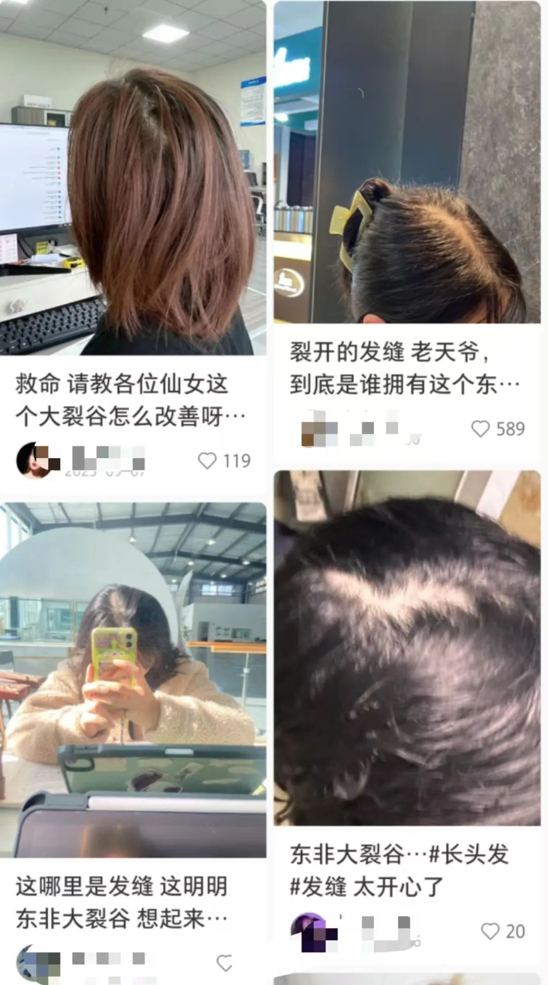 救命！发缝越来越宽，怎么办？这种情况要赶紧治疗