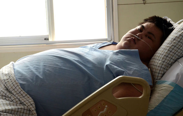 中国第一胖心肺衰竭离世体重600斤图