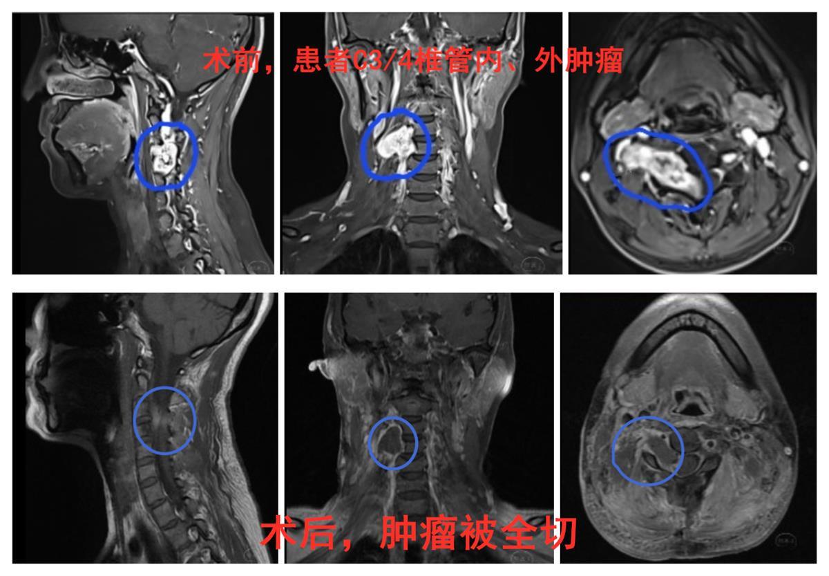 病理包埋解决方案-广州光影细胞科技有限公司