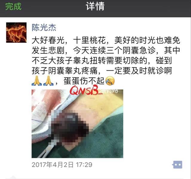 睾丸对于男性的作用不言而喻,它承担着生精和内分泌这两项重要工作。睾丸一旦发生扭转,若及时治疗还能打通血供,但如果扭转时间过长,就可能丧失功能。 在刚过去不久的清明小长第一天,浙江大学医学院附属儿童医院泌尿外科就连续接诊了三例阴囊急诊,其中一个小病患仅11岁,却因为就诊不及时,医生无奈之下只能将其扭转的睾丸切除。