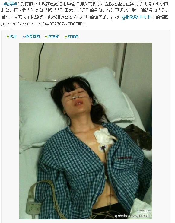 因排队起纠纷，女教师李亚娜被捅伤