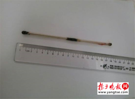 患者入院时拍的片子