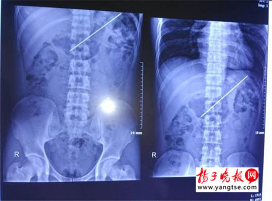 取出的钎子