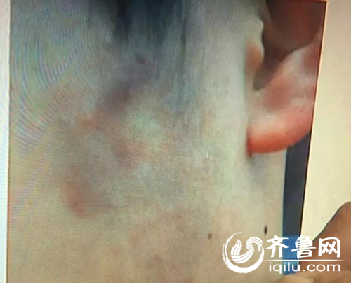 孩子被打时的照片。