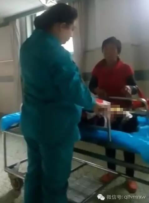 涵涵爸爸告诉《每日新闻》记者:“没想到是热水,大人也没看,一时疏忽,掉进去了。抱出来的时候这个皮已经掉了。”