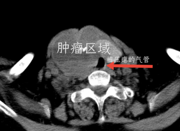 梦到已故的人口吐黑血_梦到已故亲人图片文字(3)