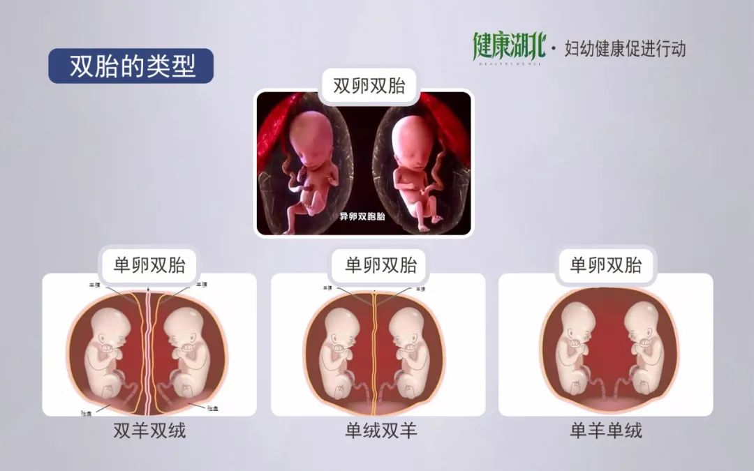 心脏病患者能怀孕吗协和专家带您解读高危妊娠