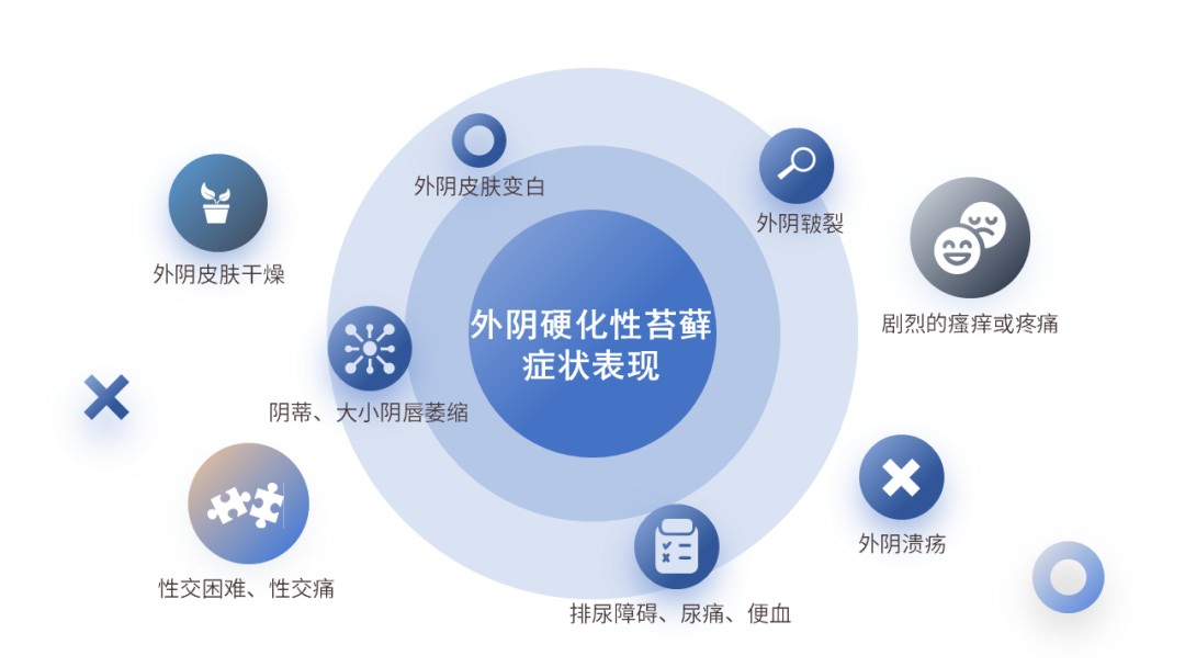 外阴瘙痒反反复复也许是外阴硬化性苔藓