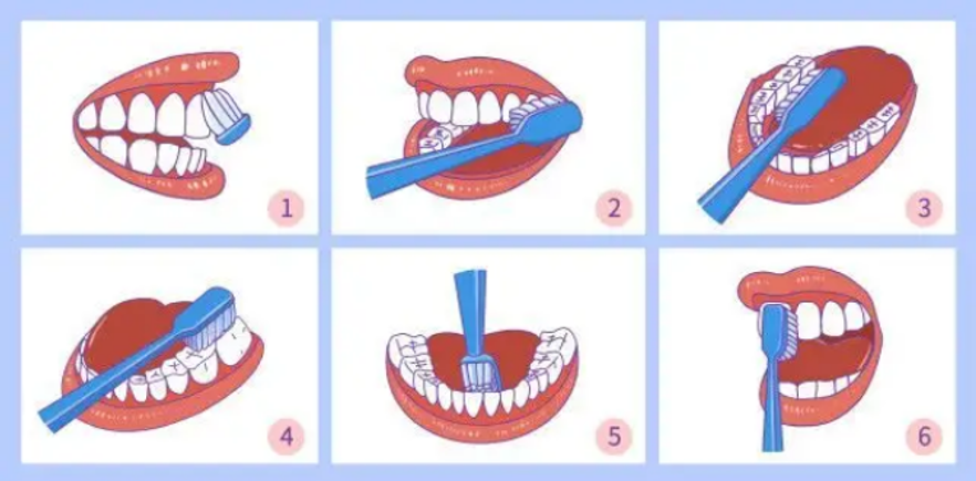 怎么洗牙图片