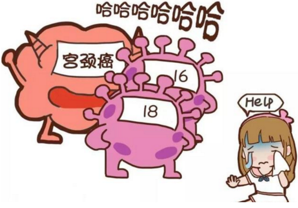 hpv和tct检查有什么区别?检查报告怎么看?