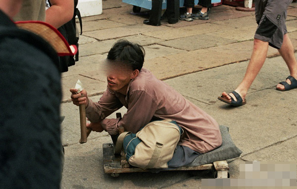 中国儿童遭拐卖到马来西亚行乞被致残毁容
