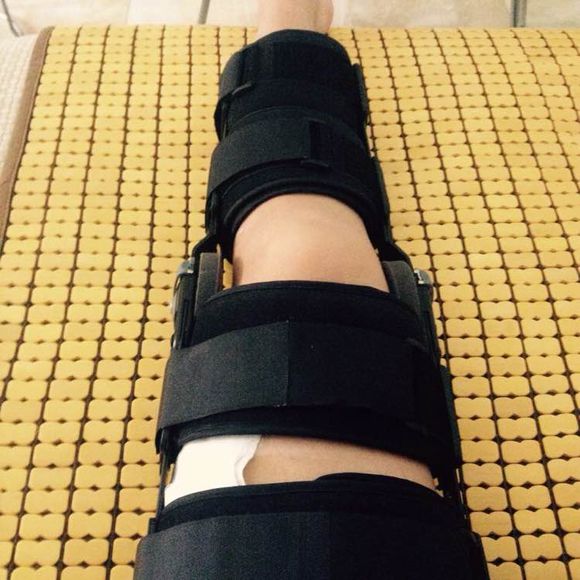 庐江男子大腿骨折到医院手术后腿短了2厘米