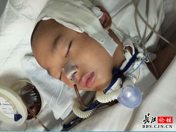 新洲8岁男孩脑部受伤昏迷不醒盼救助