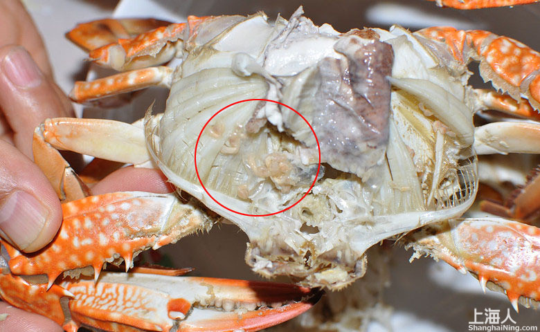 10岁男童咯血发现潜伏肺吸虫1年前吃了几只油炸河蟹