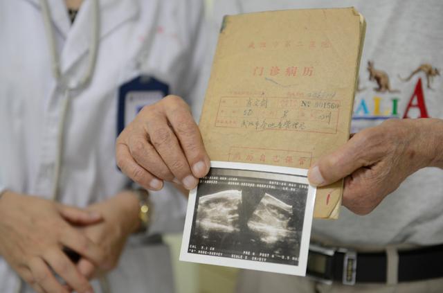 85岁老人拿着1982年的古董病历看病 35年只认一家医院